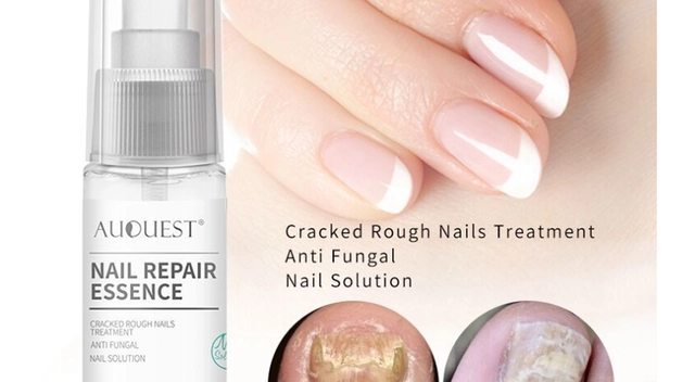 Clotrimazole for Nail Fungus: Is it Effective?